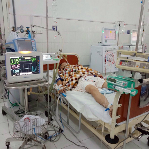 Một bệnh nhân bị ngộ độc rượu đang được điều trị tại bệnh viện. Ảnh: Bệnh viện cung cấp.