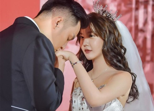 Cô gái Trung Quốc 20 tuổi phẫu thuật thẩm mỹ tổng cộng 33 lần hình ảnh 5 co gai trung quoc 20 tuoi phau thuat tham my tong cong 33 lan hinh anh 5