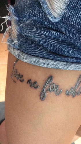 "Rợn tóc gáy" hình ảnh khách hàng bị nhiễm trùng, mưng mủ do xăm mực "dởm" - Hình 5 Rùng mình hình ảnh khách bị nhiễm trùng, mưng mủ do xăm mực “dởm“ ảnh 5