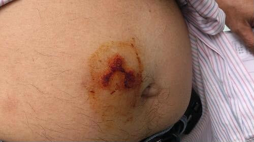 Nếu phát hiện đám trứng này trên quần áo, hãy loại bỏ ngay trước khi gánh chịu hậu quả khôn lường ảnh 5