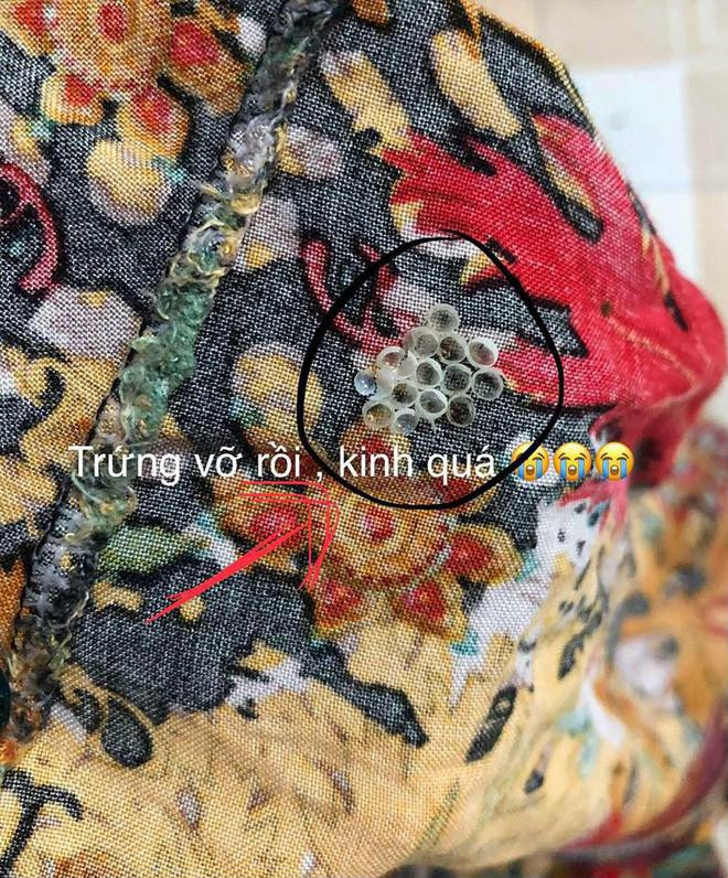 Nếu phát hiện đám trứng này trên quần áo, hãy loại bỏ ngay trước khi gánh chịu hậu quả khôn lường ảnh 1