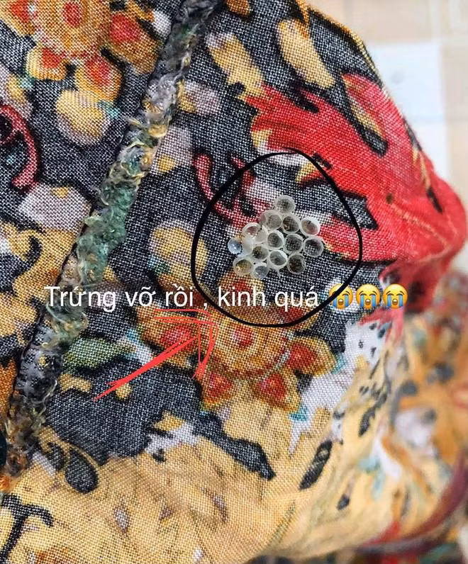 Nếu phát hiện đám trứng này trên quần áo, hãy loại bỏ ngay trước khi gánh chịu hậu quả khôn lường ảnh 1