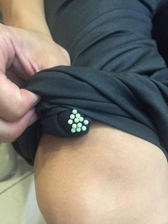 Nếu phát hiện đám trứng này trên quần áo, hãy loại bỏ ngay trước khi gánh chịu hậu quả khôn lường ảnh 3