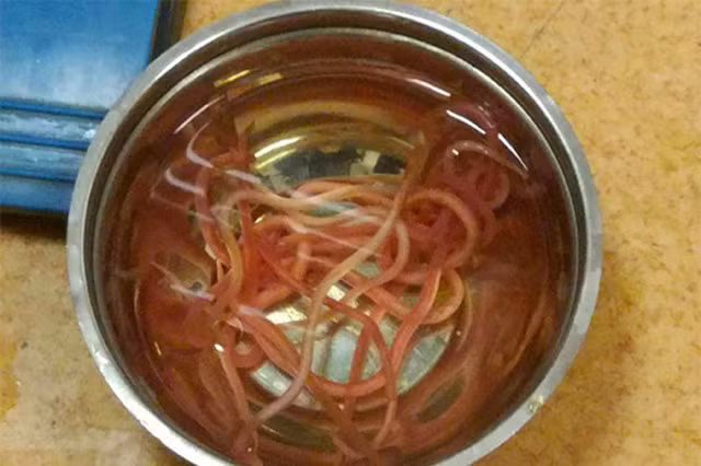 Những con giun được thả vào trong bát nước