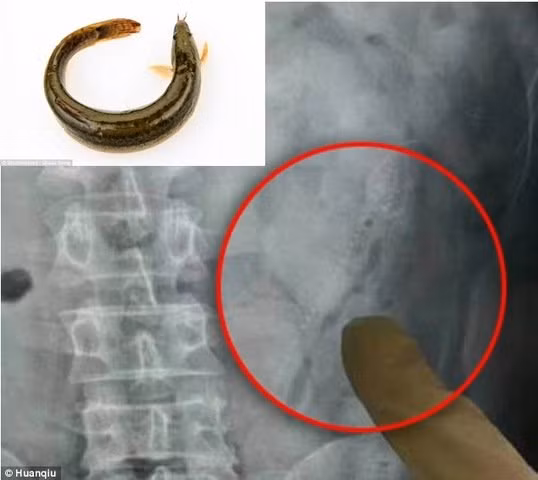 Nhét 2 con cá sống vào hậu môn và cái kết cực “thốn” 