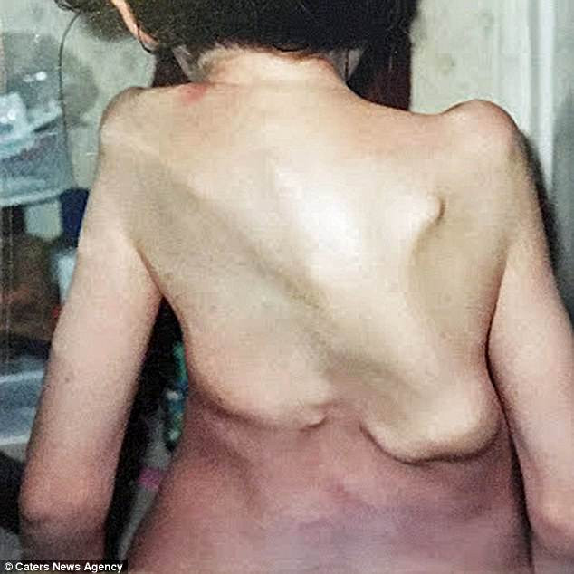 Cô gái trẻ trẻ không thể cử động vì biến thành pho tượng sống - Ảnh 2.