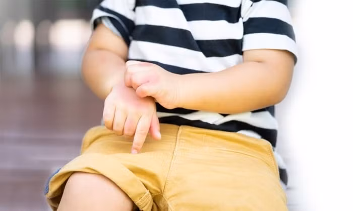 Cha mẹ nào cũng không thể không biết 8 kỹ năng sơ cứu cứu mạng trẻ trong những trường hợp khẩn cấp