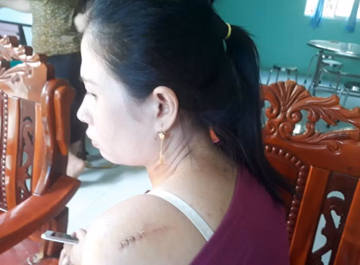 Phút kinh hoàng của cô dâu bị chồng cũ rượt chém tại tiệc cưới ảnh 2 Phút kinh hoàng của cô dâu bị chồng cũ rượt chém tại tiệc cưới ảnh 2