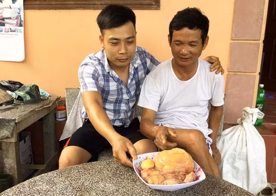 xon xao nghe an: mo ga, phat hien di vat nghi la "ke bao" cuc hiem hinh anh 1