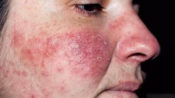 thi ra loai vat co hinh dang ghe ron nay da song tren mat chung ta bay lau nay - 8