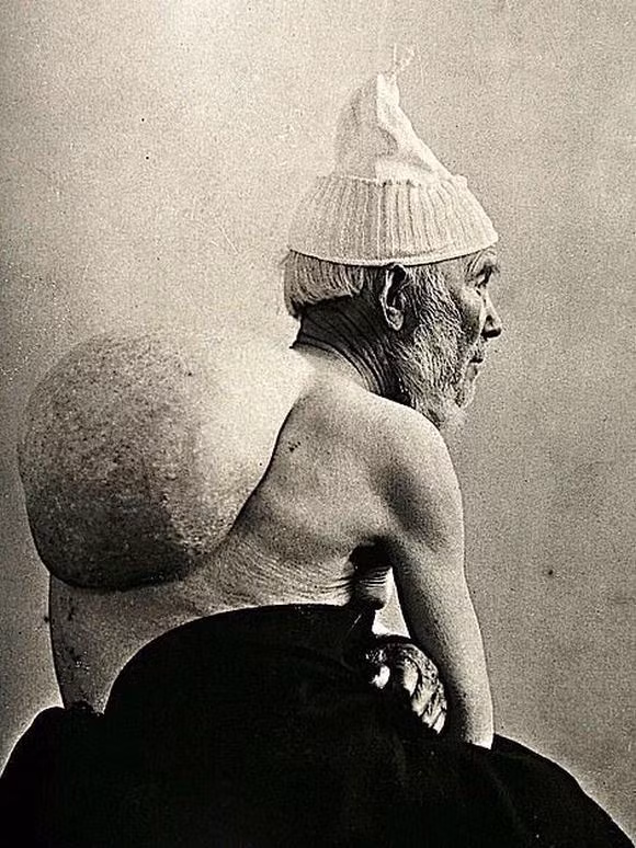 chuyện lạ, ám ảnh, y khoa