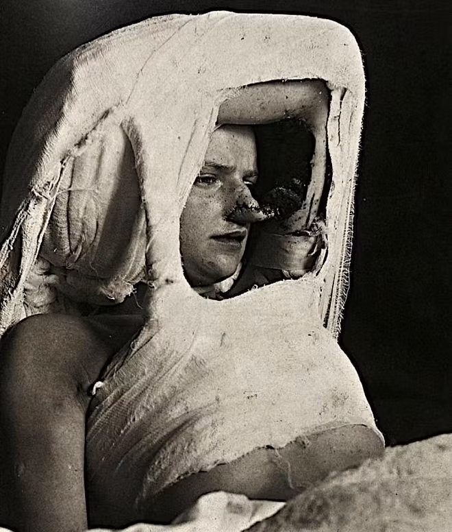 chuyện lạ, ám ảnh, y khoa