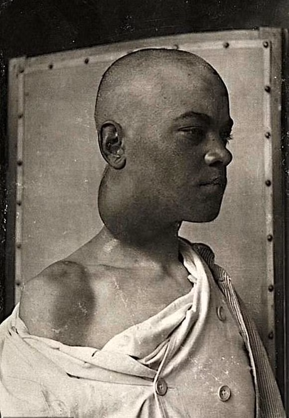 chuyện lạ, ám ảnh, y khoa