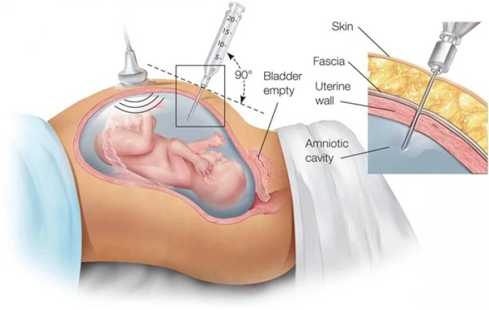 Các xét nghiệm cần thiết mẹ bắt buộc phải thực hiện trong thai kỳ