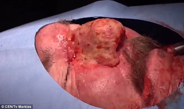 Người đàn ông có chiếc mũi to nhất thế giới - Ảnh 5.