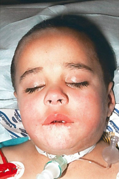 Sau tai nạn 4 năm, Ayman vẫn cần được chăm sóc suốt ngày đêm để quản lý thủ thuật mở ống thông khí quản. Sau tai nạn 4 năm, Ayman vẫn cần được chăm sóc suốt ngày đêm để quản lý thủ thuật mở ống thông khí quản - Ảnh:Slater and Gordon/ PA.