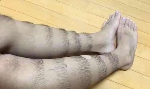 Nam sinh bỗng chốc nổi tiếng khắp Nhật Bản bằng cách nhổ lông chân theo hình họa tiết - Hình 3