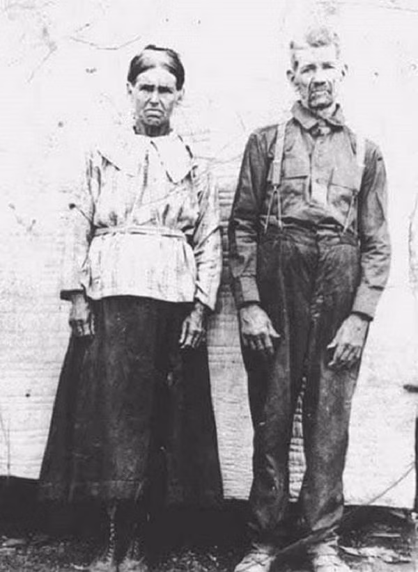 Câu chuyện ly kỳ về gia tộc người ngoài hành tinh có thật 100% ở Mỹ: Cả gia đình màu xanh da trời và lời nguyền đeo bám hàng trăm năm-2