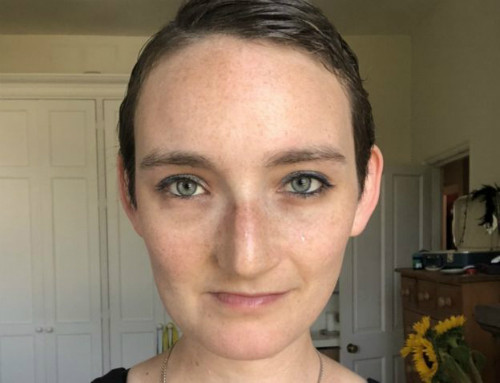 Khuôn mặt xinh đẹp củaJen Taylor sau khi phẫu thuật tái tạo. Khuôn mặt xinh đẹp củaJen Taylor sau khi phẫu thuật tái tạo.