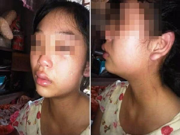 Mẹ trẻ 16 tuổi đăng Facebook cầu cứu vì bị chồng liên tục bạo hành