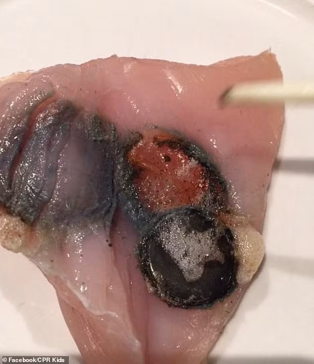 Sự thật mọi cha mẹ đều nên biết: Hình ảnh ghi lại điều đáng sợ sẽ xảy ra nếu trẻ nuốt phải pin - Ảnh 2.