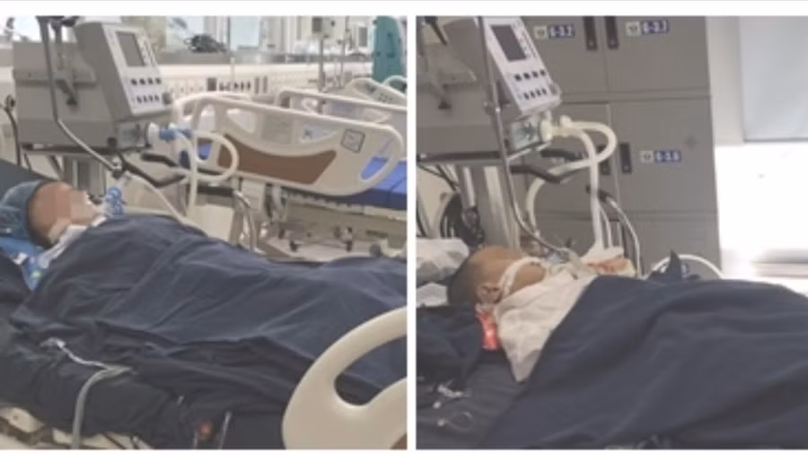 Cùng một ngày, 3 bệnh nhi bị ong đốt nguy kịch