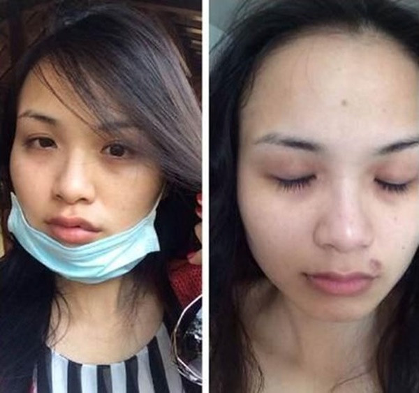 Những mỹ nhân Việt từng bị chồng đánh đập tàn tạ, nguy hiểm tính mạng ảnh 4 Empty