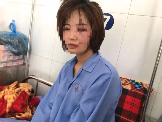 Hà Nội: Truy nã các đối tượng hành hung nữ phụ xe bus - 3