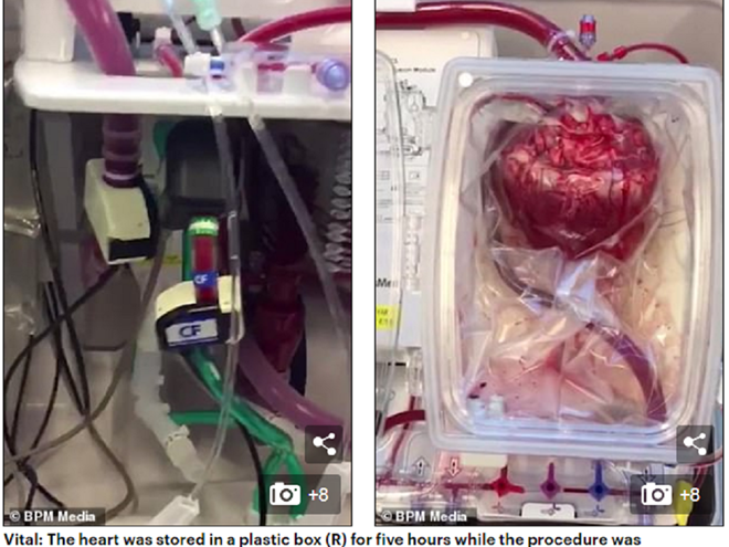 Chờ ghép tạng, quả tim được đặt trong hộp nhựa... vẫn đập ảnh 1 Hệ thống giúp bơm máu vào tim (trái) và quả tim ghép được đặt trong hộp nhựa chuẩn bị ghép cho ông James Walton (phải) /// Ảnh chụp màn hình Daily Mail