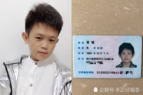 Cặp đôi 34 tuổi bỗng kiếm bộn tiền nhờ sở hữu ngoại hình trẻ con-1