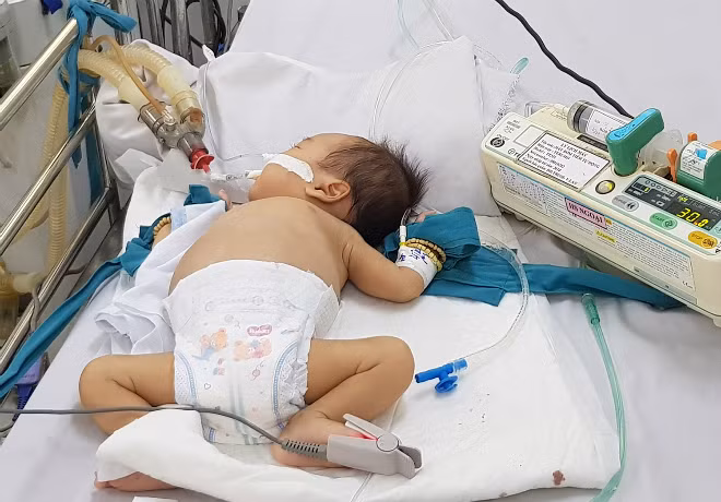 Trẻ tay chân miệng bệnh nặng điều trị tại phòng cấp cứu Khoa Nhiễm, Bệnh viện Nhi đồng 1 (TP HCM) ngày 5/10. Ảnh: Lê Phương.