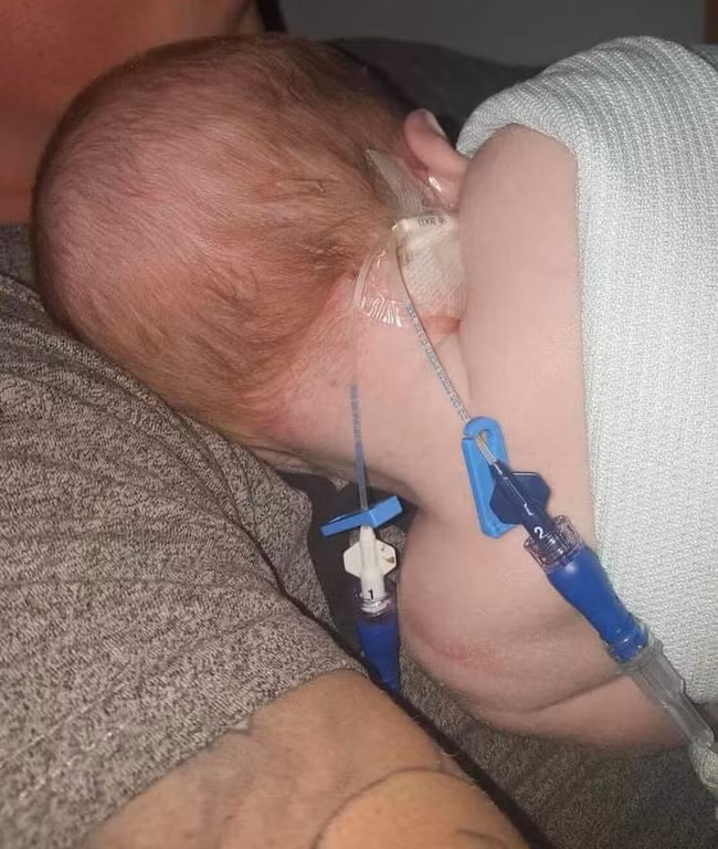 Lại thêm một bé sơ sinh nhiễm virus herpes từ nụ hôn của người khách lạ - Ảnh 3.