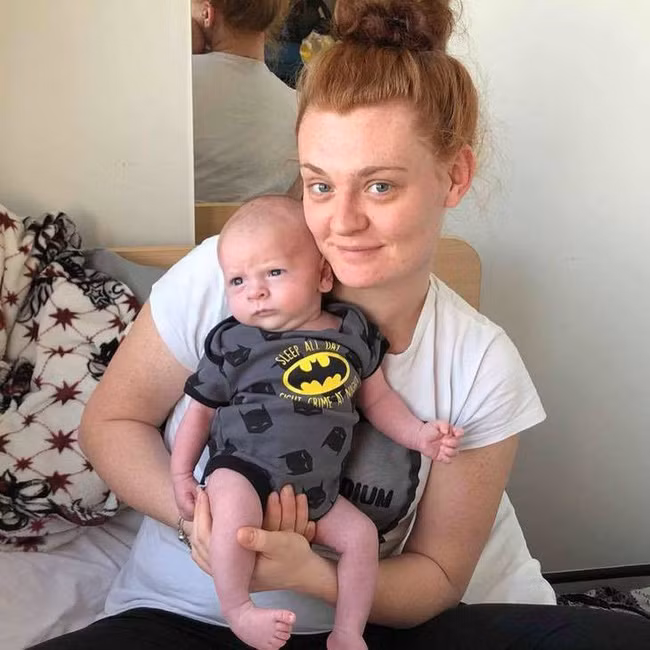 Lại thêm một bé sơ sinh nhiễm virus herpes từ nụ hôn của người khách lạ - Ảnh 5.