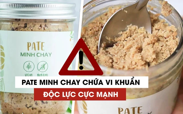 Các bệnh nhân ngộ độc pate Minh Chay vẫn tiên lượng nặng, thuốc giải độc gần 200 triệu/liều