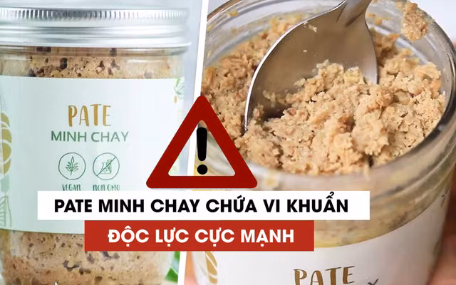 Các bệnh nhân ngộ độc pate Minh Chay vẫn tiên lượng nặng, thuốc giải độc gần 200 triệu/liều