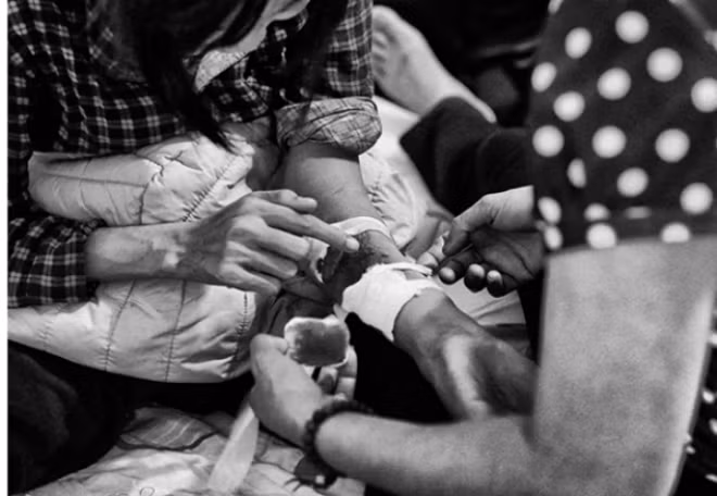 Bệnh nhân suy thận ở Việt Nam. Ảnh: Đỗ Mạnh Cường.