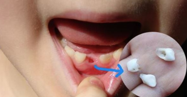 Đừng bao giờ vứt bỏ chiếc răng sữa của con, nó là vật rất hữu ích con bạn sẽ cần đến sau này