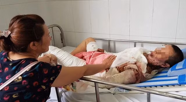 Ớn lạnh những vụ dùng xăng để giải quyết ân oán tình cảm! - 5