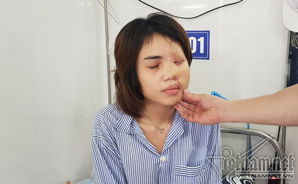 Bác sĩ kể lại hành trình hồi sinh gương mặt xinh đẹp cho cô gái bị thiếu úy tạt axit Bác sĩ kể lại hành trình hồi sinh gương mặt xinh đẹp cho cô gái bị thiếu úy tạt axit