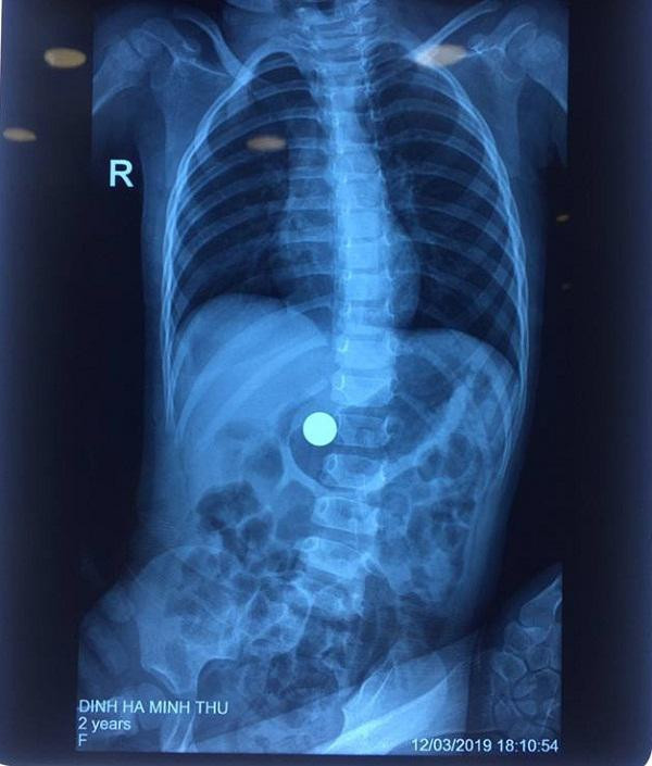 be 21 thang ha noi khoc nac quan nguoi, suyt chet vi ba khoang tay vao mieng moc di vat - 3