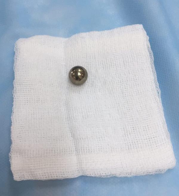 be 21 thang ha noi khoc nac quan nguoi, suyt chet vi ba khoang tay vao mieng moc di vat - 2