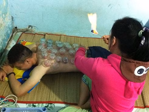 Giác hơi cắt lễ hút "máu độc" coi chừng nhiễm HIV