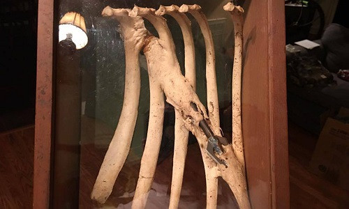 Xương mọc xung quanh mũi tên sau khi con hươu bị bắn gãy xương sườn. Ảnh: Jackie Stegall.