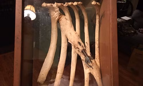 Xương mọc xung quanh mũi tên sau khi con hươu bị bắn gãy xương sườn. Ảnh: Jackie Stegall.