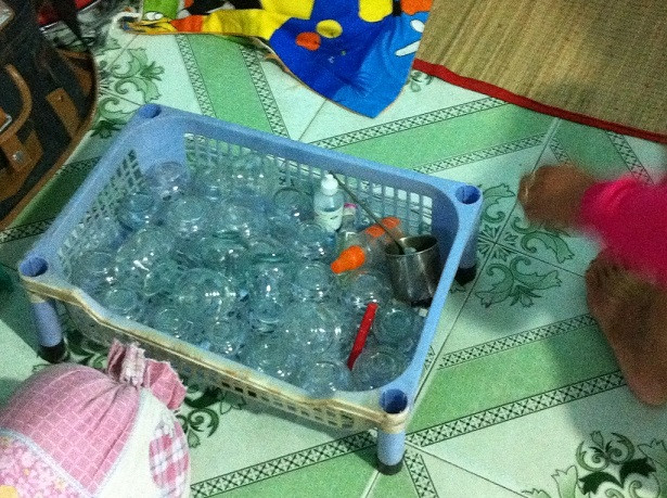 Giác hơi cắt lễ hút "máu độc" coi chừng nhiễm HIV ảnh 1