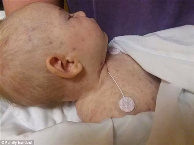 Bé 4 tháng tuổi tử vong do bị viêm màng não sau khi tiếp xúc với một người chưa được tiêm chủng tại nhà trẻ - ảnh 1