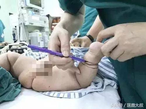 tuong chan chau dinh ban, ba noi ra suc rua, ai ngo suyt chut nua bac si phai cat bo - 1