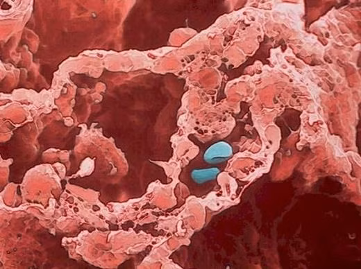 Cực kì kinh ngạc: Những thứ rùng rợn này nằm ngay trên cơ thể bạn! ảnh 16