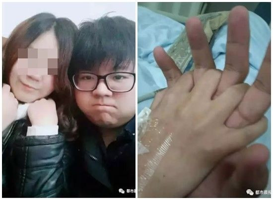 Cảm động ‘nụ hôn vĩnh biệt’ của chàng trai dành cho bạn gái trước khi qua đời ảnh 1 Tôn Dương vốn luôn lạc quan tin rằng, Viêm Đệ sẽ sớm xuất viện và kết hôn cùng anh.