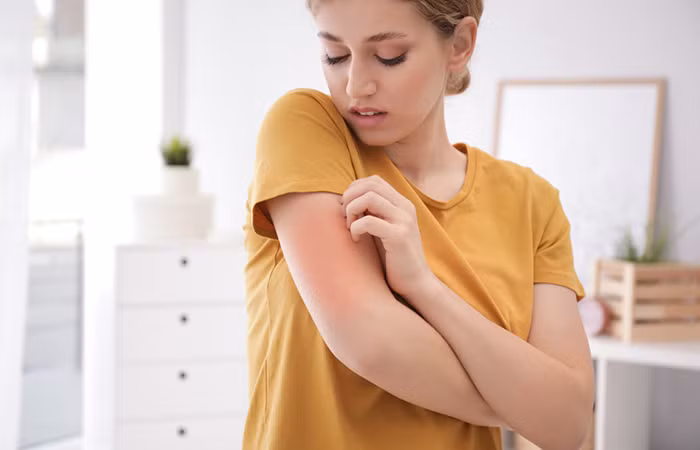 Những người bị dị ứng với phấn hoa, trà hoa cúc, chuối và hạt hướng dương cũng có thể bị dị ứng sau khi ăn dưa chuột. (Ảnh: ITN)